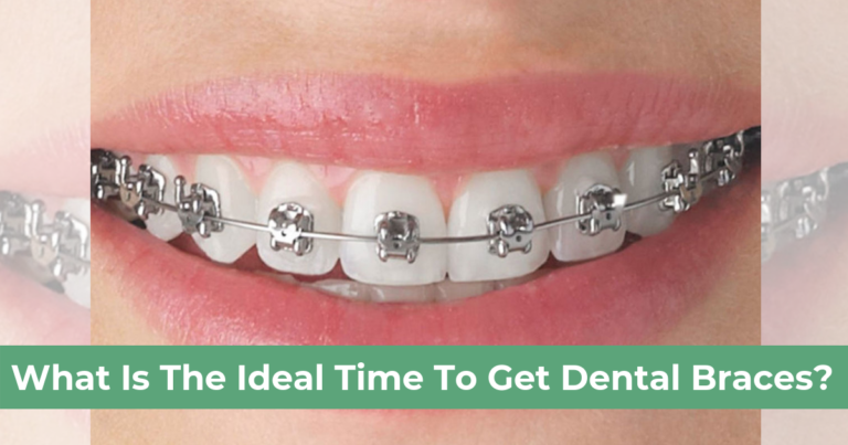 what-is-the-ideal-time-to-get-dental-braces