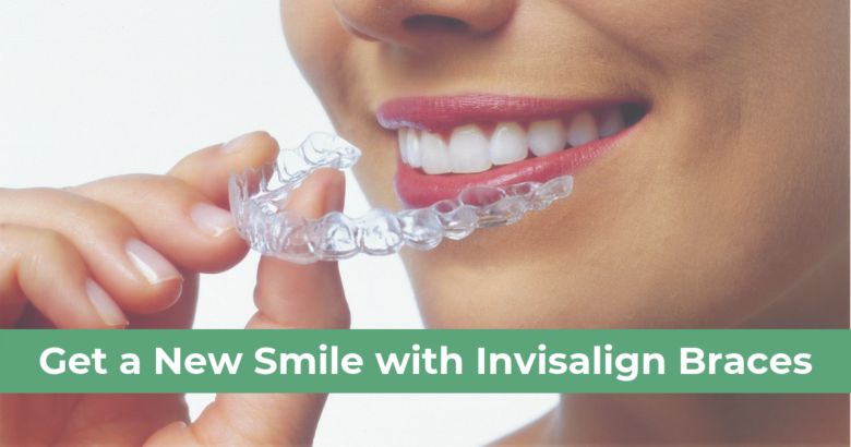 Get a New Smile with Invisalign Braces Treatment